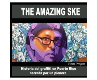 The Amazing Ske