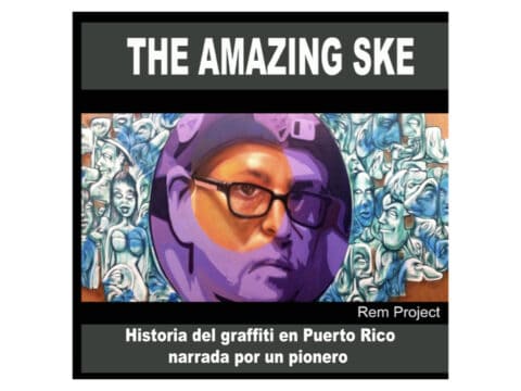 The Amazing Ske